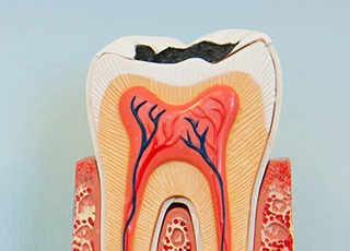 Animation of inside of tooth